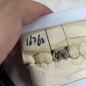 Cobalt-chromium Dental Crown